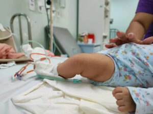 AM tem alta de internações infantis por Síndrome Respiratória Aguda Grave