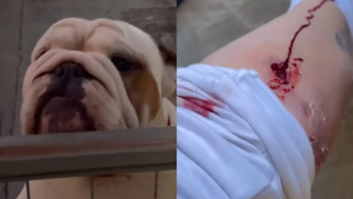 VÍDEO: Influenciadora é atacada pelo próprio cão e fica ferida, em SC