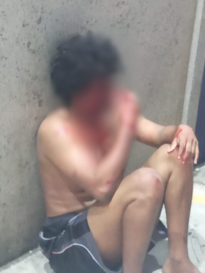 Suspeito de assalto é brutalmente espancado por moradores no bairro Petrópolis