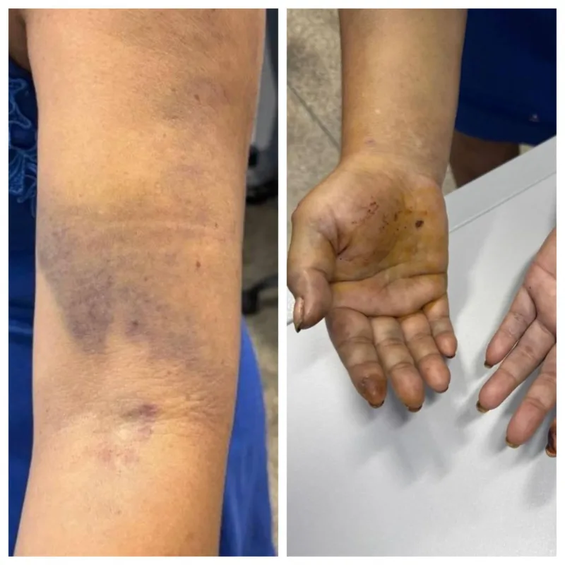 Suspeitos de torturar mulher e estuprar adolescentes de 12 e 13 anos no Amazonas