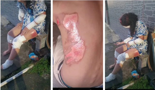 'Rolezeiros' caem de moto durante fuga da polícia em Manaus