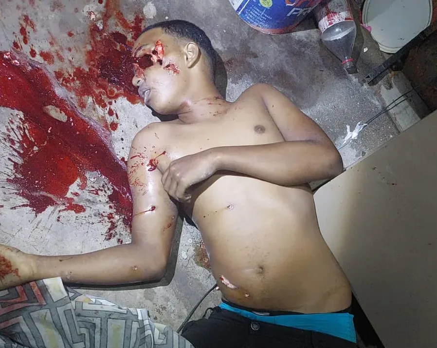 Adolescente tem olho arrancado a tiros ao ser executado em Manaus