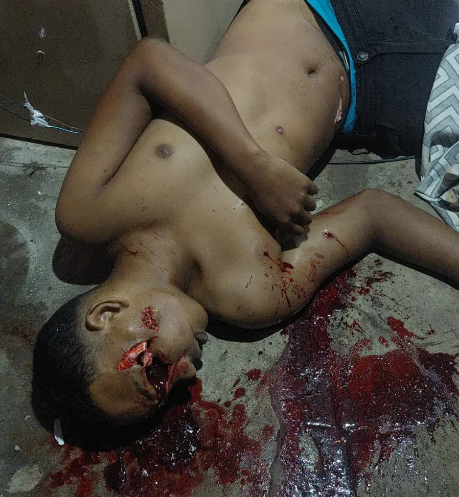 Adolescente tem olho arrancado a tiros ao ser executado em Manaus